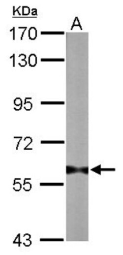 PRMT3 Antibody, Novus Biologicals 0.1mL; Unlabeled:Antibodies, Polyclonal
