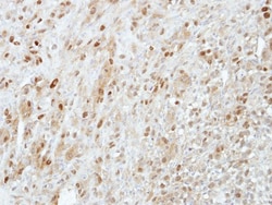 PRMT5 Antibody, Novus Biologicals 0.1mL; Unlabeled:Antibodies, Polyclonal