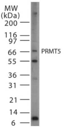 PRMT5 Antibody, Novus Biologicals 0.2mL; Unlabeled:Antibodies, Polyclonal
