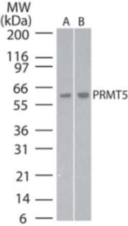 PRMT5 Antibody, Novus Biologicals 0.2mL; Unlabeled:Antibodies, Polyclonal