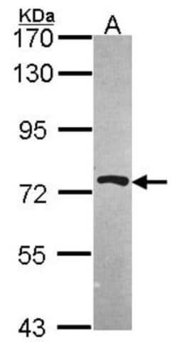 PRMT5 Antibody, Novus Biologicals 0.1mL; Unlabeled:Antibodies, Polyclonal