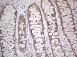 PRMT5 Antibody (OTI2H3), Novus Biologicals 0.1mL; Unlabeled:Antibodies,