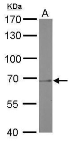 PRMT5 Antibody (3610), Novus Biologicals 0.1 mL | Buy Online | Novus Biologicals | Fisher Scientific