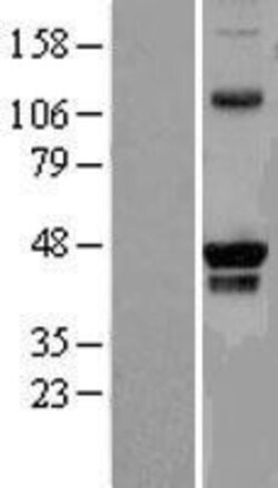 Novus Biologicals&trade;&nbsp;PRMT8 Overexpression Lysate