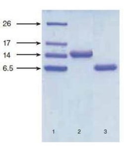 NT-proBNP Antibody (11D1cc), Novus Biologicals 0.2mg; Unlabeled:Antibodies,