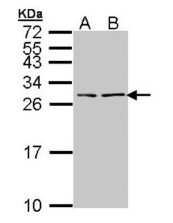 NPPB Antibody, Novus Biologicals 0.1mg; Unlabeled:Antibodies, Polyclonal