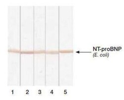 NT-proBNP Antibody (11D1cc), Novus Biologicals 0.2mg; Unlabeled:Antibodies,
