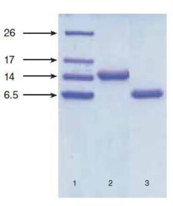 NT-proBNP Antibody (13G12cc), Novus Biologicals 0.2mg; Unlabeled:Antibodies,