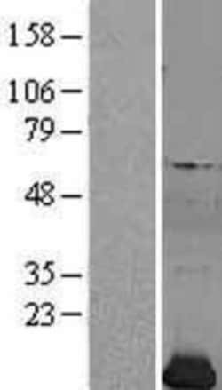 Novus Biologicals&trade;&nbsp;Profilin 2 Overexpression Lysate
