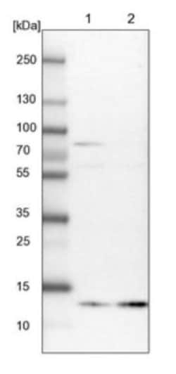 Profilin 2 Antibody, Novus Biologicals 25 &mu;L; Unlabeled:Antibodies,