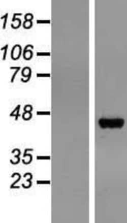 Novus Biologicals&trade;&nbsp;Pepsinogen C/PGC/Progastricsin Overexpression Lysate