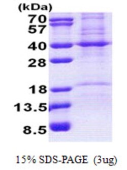 Novus Biologicals Recombinant Human Prohibitin 2 His Protein 0.1 mg | Buy Online | Novus Biologicals&trade; | Fisher Scientific