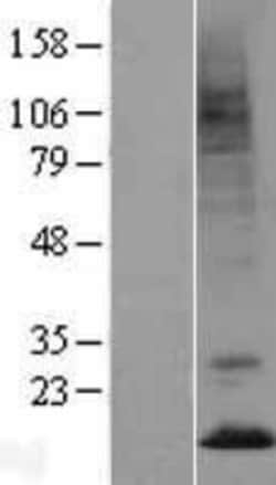 Novus Biologicals&trade;&nbsp;Prokineticin 2 Overexpression Lysate