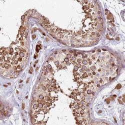 Prokineticin R2/PROKR2 Antibody, Novus Biologicals 0.1mL; Unlabeled:Antibodies,