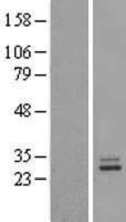 Novus Biologicals&trade;&nbsp;Prolactin Overexpression Lysate