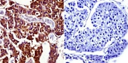 Prolactin R Antibody (T6) - Azide and BSA Free, Novus Biologicals 0.1mg;