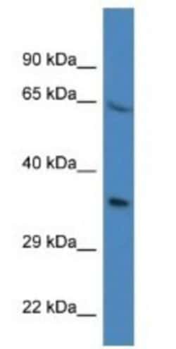 Proline rich 16 Antibody, Novus Biologicals 100&mu;L; Unlabeled:Antibodies,