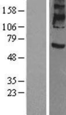 Novus Biologicals&trade;&nbsp;Prominin 2 Overexpression Lysate