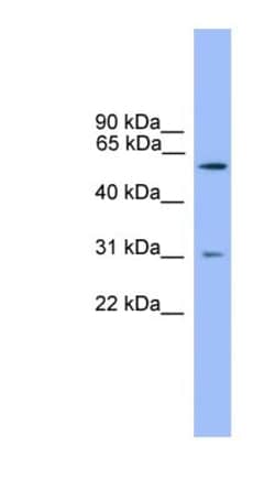 Proprotein Convertase 2/PCSK2 Antibody, Novus Biologicals:Antibodies:Primary