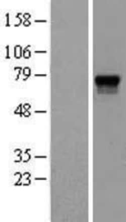 Novus Biologicals™ Proprotein Convertase 2/PCSK2 Overexpression Lysate