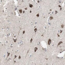 Proprotein convertase PC4 Antibody, Novus Biologicals:Antibodies:Primary