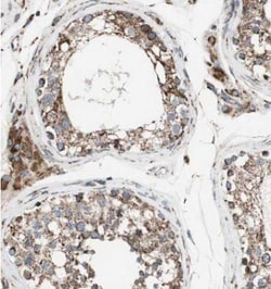 Proprotein convertase PC4 Antibody, Novus Biologicals:Antibodies:Primary