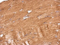 PROSC Antibody, Novus Biologicals 0.1mL; Unlabeled:Antibodies, Polyclonal