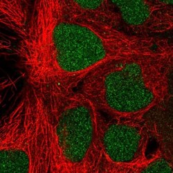 PROSER1 Antibody, Novus Biologicals:Antibodies:Primary Antibodies