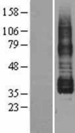Novus Biologicals&trade;&nbsp;PTGIR Overexpression Lysate