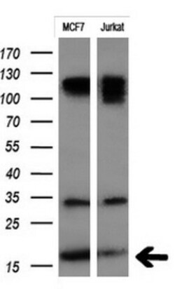 PSP94/MSMB Antibody (OTI3D5), Novus Biologicals 0.1mL; Unlabeled:Antibodies,