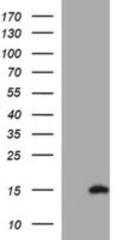 PSP94/MSMB Antibody (OTI3D5), Novus Biologicals 0.1mL; Unlabeled:Antibodies,