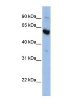SLC45A3/Prostein Antibody, Novus Biologicals 0.05mg; Unlabeled:Antibodies,