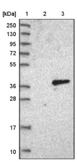 Protease Inhibitor 15 Antibody, Novus Biologicals 0.1mL; Unlabeled:Antibodies,