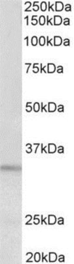 Protease Inhibitor 15 Antibody, Novus Biologicals 0.1mg; Unlabeled:Antibodies,