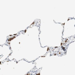 Protease Inhibitor 15 Antibody, Novus Biologicals 0.1mL; Unlabeled:Antibodies,