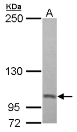 Proteasome 19S 10B Antibody, Novus Biologicals 0.1mL; Unlabeled:Antibodies,