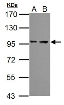 Proteasome 19S 10B Antibody, Novus Biologicals 0.1mL; Unlabeled:Antibodies,