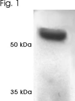 PSMC1 Antibody, Novus Biologicals 0.1mL; Unlabeled:Antibodies, Polyclonal