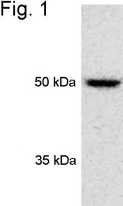 S5a/Angiocidin Antibody, Novus Biologicals 0.2mL; Unlabeled:Antibodies,
