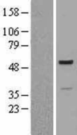 Novus Biologicals&trade;&nbsp;Proteasome 19S S7 Overexpression Lysate