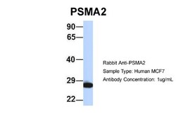 PSMA2 Antibody, Novus Biologicals 100&mu;L; Unlabeled:Antibodies, Polyclonal