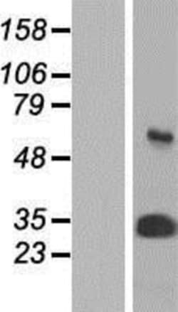 Novus Biologicals&trade;&nbsp;Proteasome 20S alpha 3 Overexpression Lysate