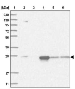 Proteasome 20S alpha 5 Antibody, Novus Biologicals 0.1mL; Unlabeled:Antibodies,