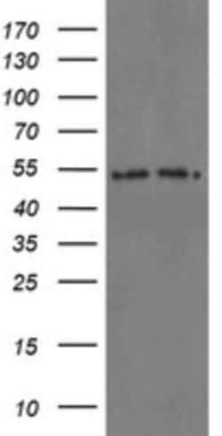 Proteasome 20S alpha 6 Antibody (OTI3B8), Novus Biologicals 0.1 mL | Buy Online | Novus Biologicals | Fisher Scientific