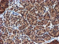Proteasome 20S alpha 6 Antibody (OTI4C9), Novus Biologicals 0.1mL; Unlabeled:Antibodies,