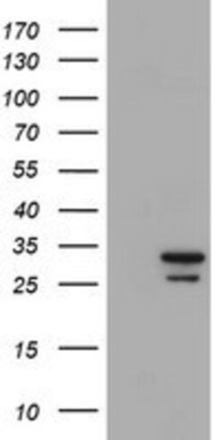 Proteasome 20S alpha 6 Antibody (OTI4C9), Novus Biologicals 0.1mL; Unlabeled:Antibodies,