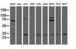 Proteasome 20S alpha 6 Antibody (OTI4C9), Novus Biologicals 0.1mL; Unlabeled:Antibodies,