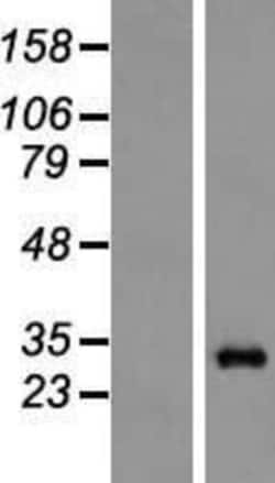 Novus Biologicals&trade;&nbsp;Proteasome 20S alpha 6 Overexpression Lysate