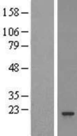 Novus Biologicals™ Proteasome 20S beta 3 Overexpression Lysate