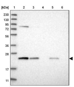 Proteasome 20S beta 6 Antibody, Novus Biologicals:Antibodies:Primary Antibodies